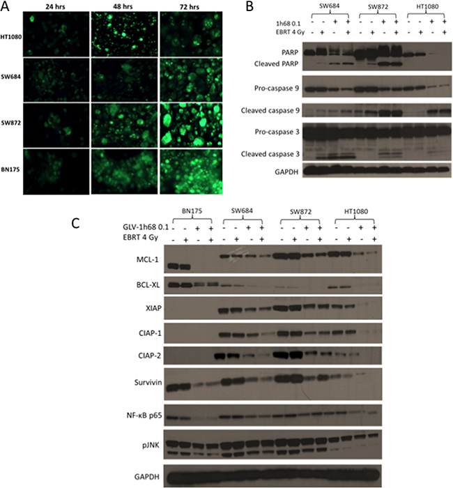 Efficient infection of cells, with the GFP producing GLV-1h68, leads to apoptotic cell death due to the loss of the anti-apoptotic MCL-1 protein and the inhibitors of apoptosis (IAPs).