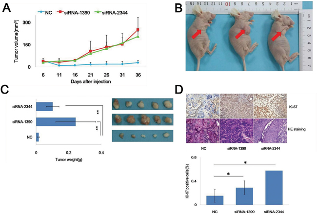Knockdown of CDH4 promotes SACC-83 cell tumorigenicity in vivo.