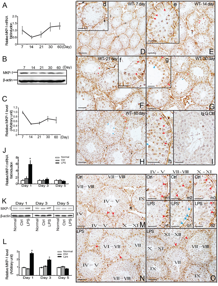 Expression and distribution of MKP-1 in the developing testes and LPS-induced acute testis inflammation.