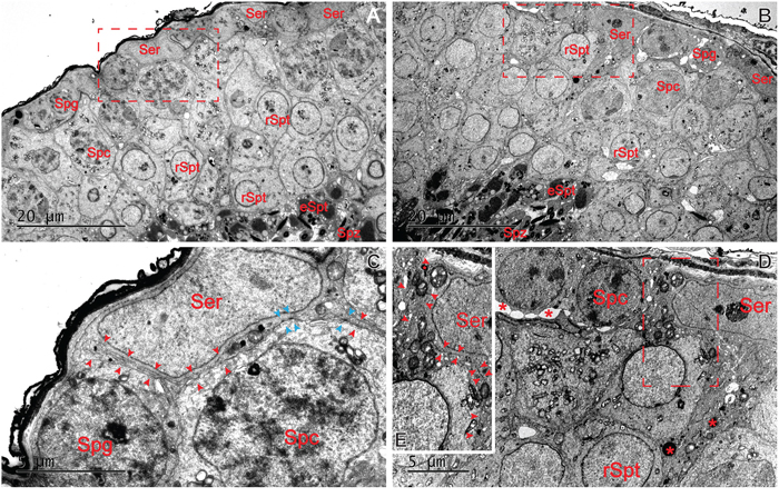 Ultrastructural changes at the BTB by LPS stimuli in adult mouse testes.