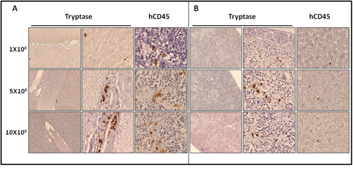 Localization of primary engrafted ROSAKIT D816V-Gluc cells in mice spleen and liver by IHC detection of tryptase and hCD45.