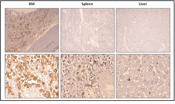 Localization of previously xenotransplanted ROSAKIT D816V-Gluc cells in mice BM using IHC detection of hCD45 after secondary transplantation.