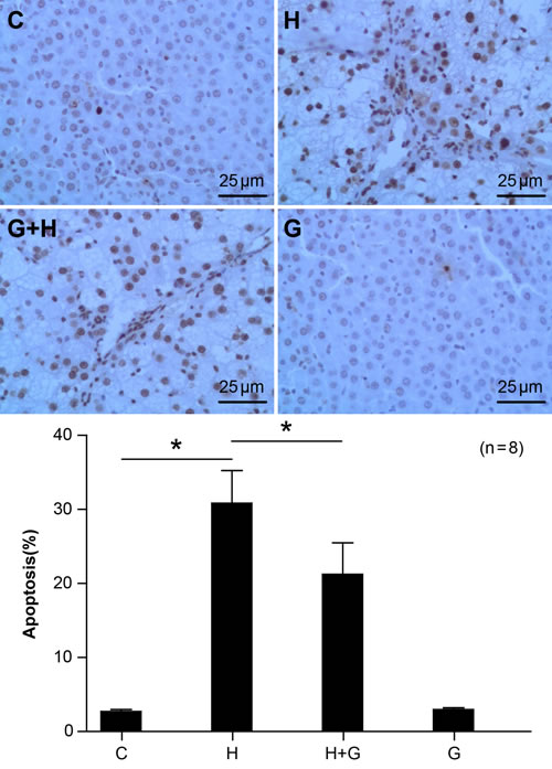 Effect of glycine treatment on hepatocyte apoptosis.