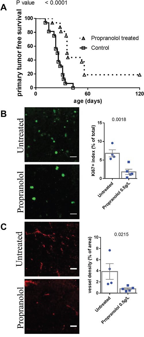 Comparison of tumor development in untreated control and propranolol treated MT/ret mice.
