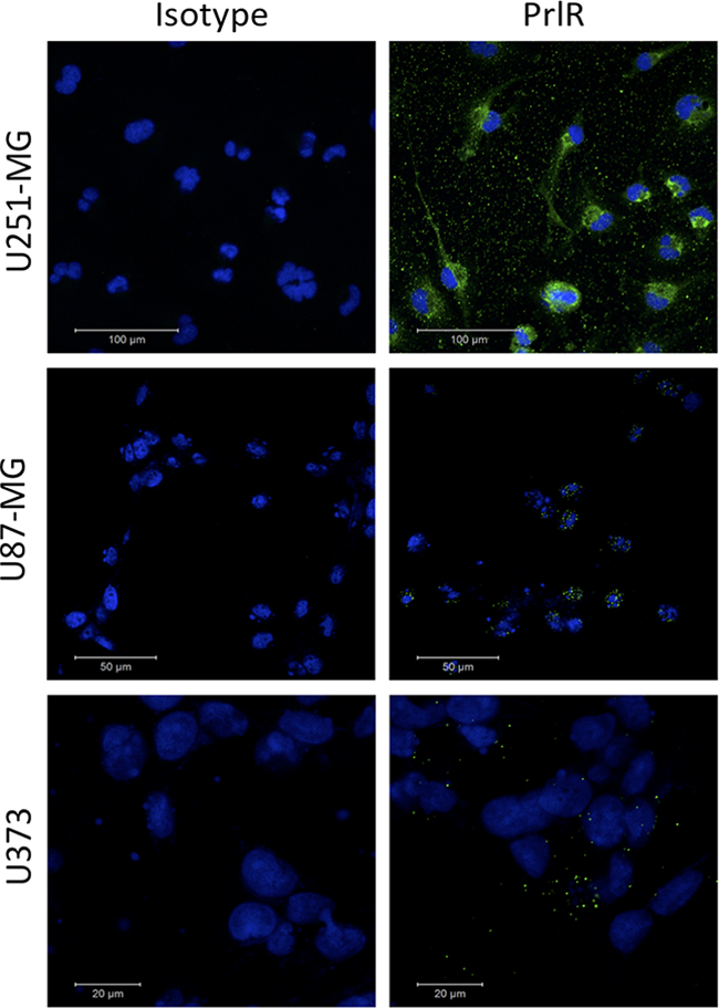 Immunofluorescence visualization of PrlR in U251-MG, U87-MG and U373 cells.