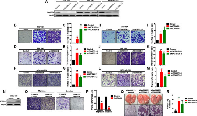 Loss of SORBS1 increases breast cancer cells migration and invasion properties both