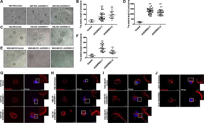 Loss of SORBS1 expression triggers increased protrusion formation and abundant FLPs in 3D culture.