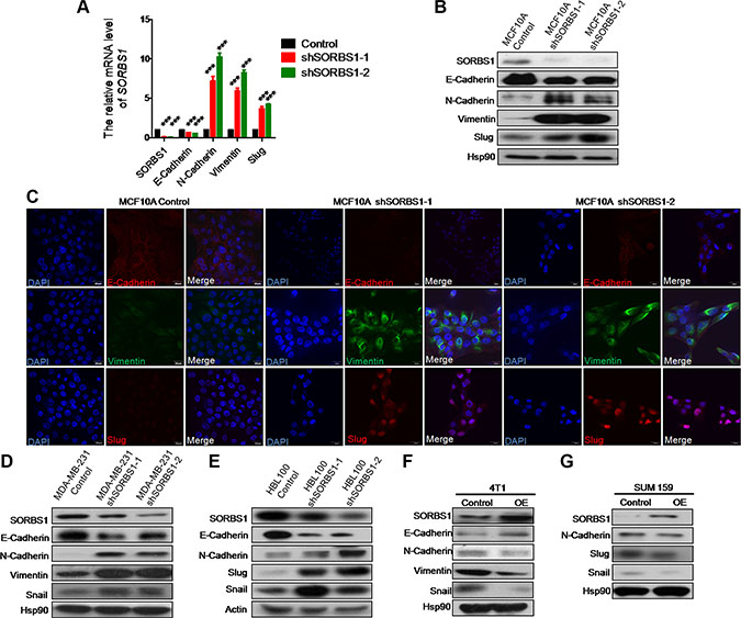 Knockdown of SORBS1 induces epithelial-to-mesenchymal transition in breast cancer cells.