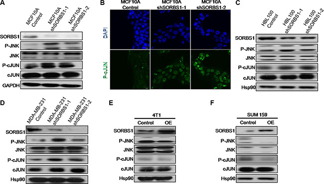 SORBS1 inhibits JNK signaling pathway.