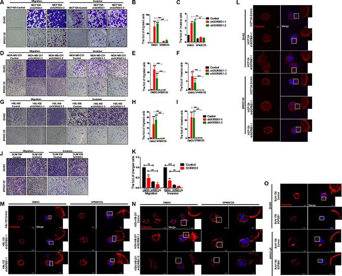 Inhibition of JNK activity decreases migration, invasion and FLP