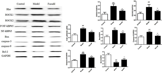 Fasudil inhibited Rho-mediated inflammatory signalings in hippocampus by Western Blot.