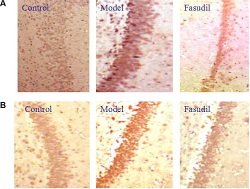 Fasudil regulated Rho-mediated inflammatory signalings in hippocampus by immunohistochemistry.