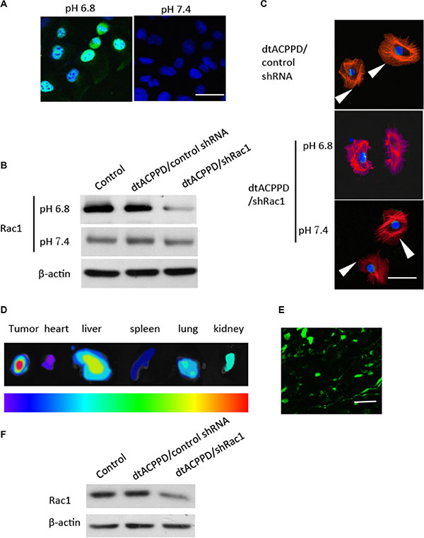 Penetration of dtACPPD/shRNA nanoparticles in colon cancer cells in vitro and in vivo.