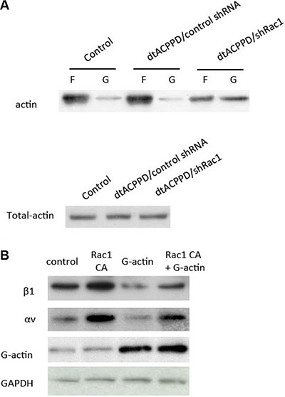 Rac1 regulates cell to matrix adhesion via cytoskeletal reorganization.