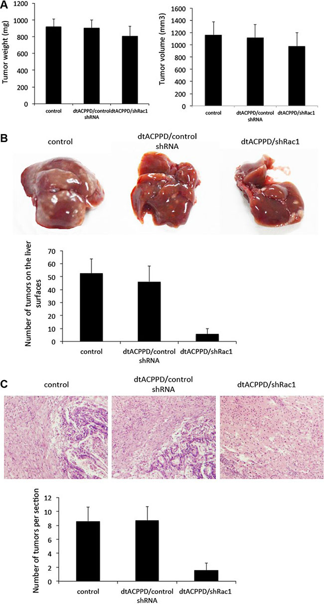 dtACPPD /shRNA nanoparticles inhibited the growth of colon cancer xenografts and liver metastasis in nude mice.