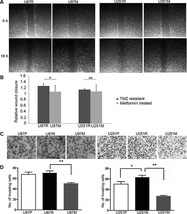 Metformin inhibits migration and growth of TMZ-resistant glioblastoma cells.