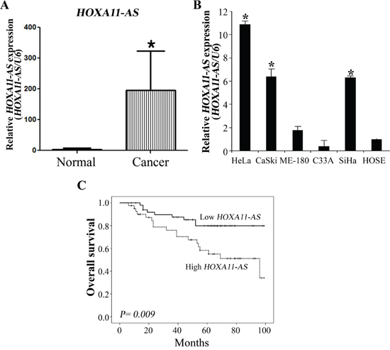 Relative HOXA11-AS expression and its clinical significance.