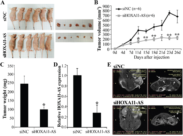 Effect of HOXA11-AS on tumor growth in vivo.