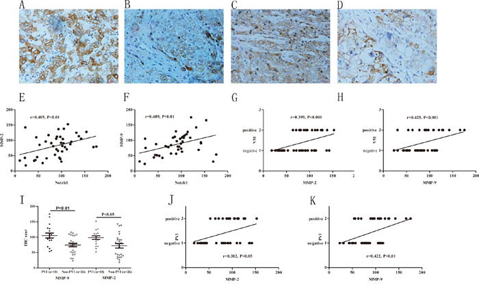 Increased expressions of MMPs associated with VM and higher incidence of PVI.