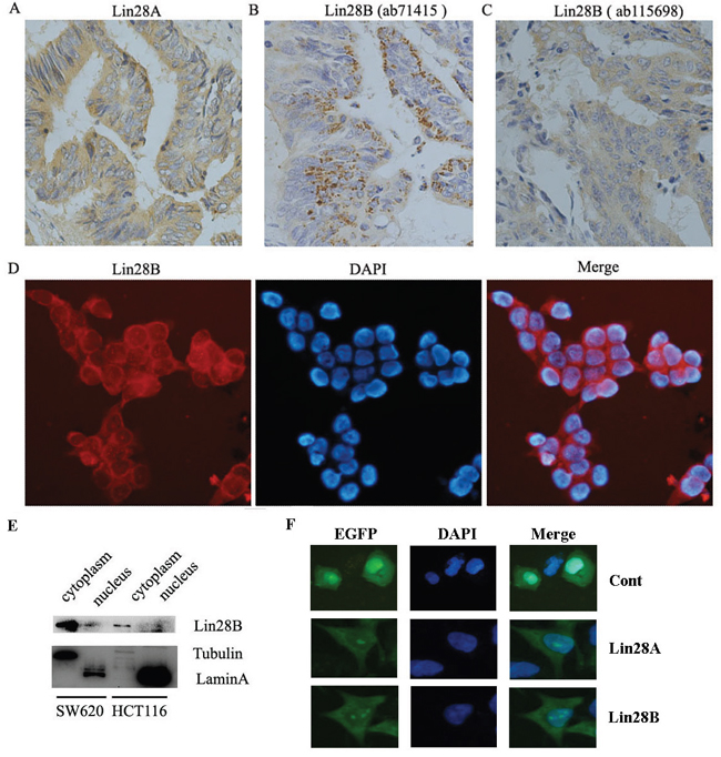 Lin28A and Lin28B are predominantly distributed in the cytoplasm of colon cancer cells.