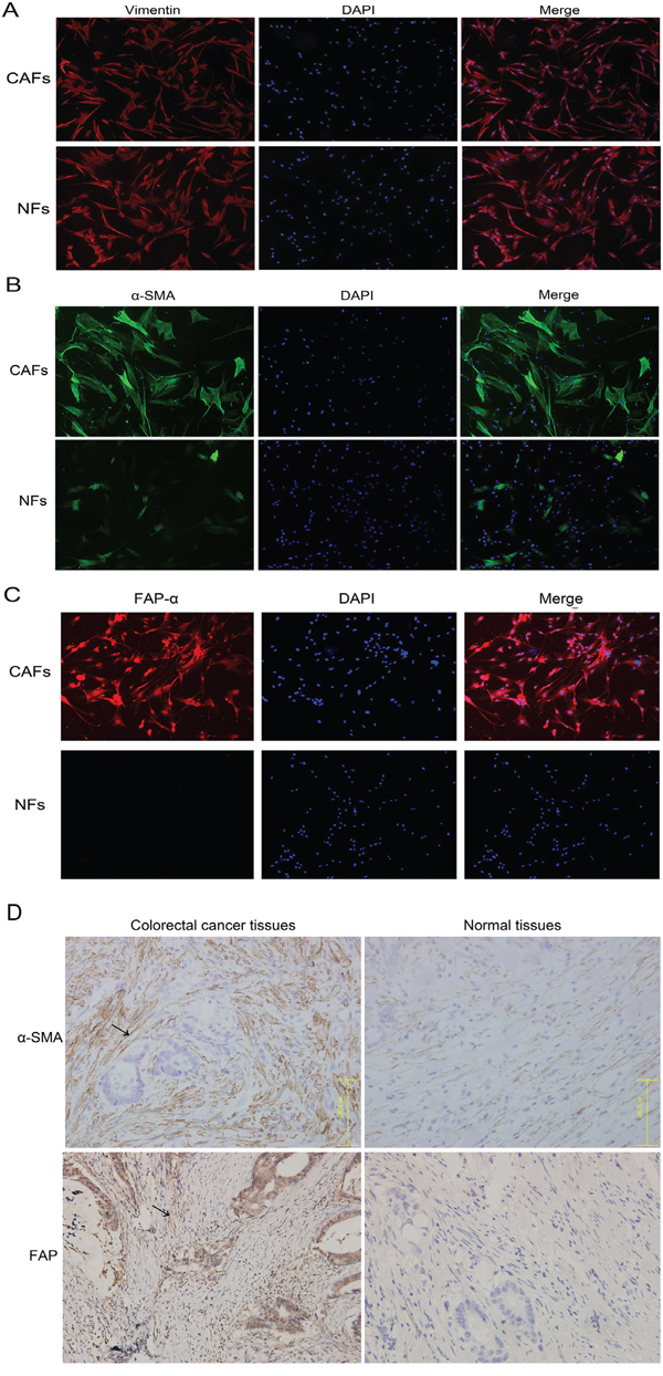 CAF and NF distinction and identification and immunohistochemistry was used to locate the positions of CAFs/NFs in colorectal cancer and normal tissues.