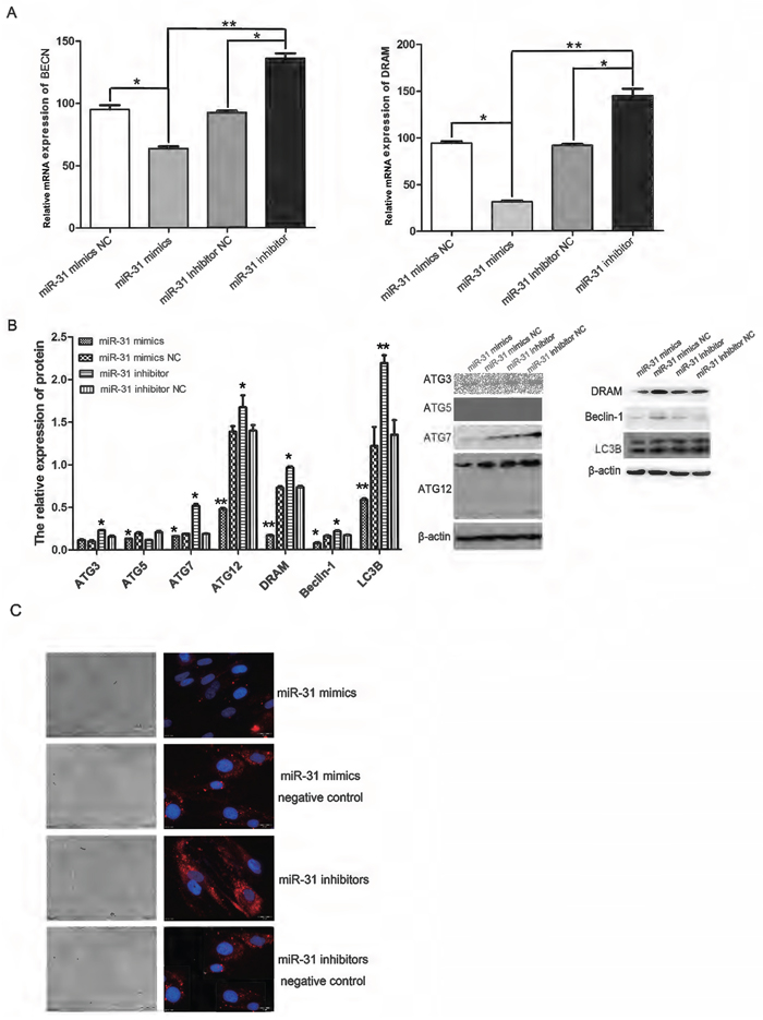 Up- or down-regulation of miR-31 in CAFs inhibited and promoted, respectively, the expression of autophagy-related genes at both the protein and RNA level.