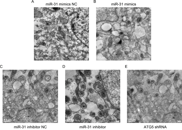 Up- or down-regulation of miR-31 in CAFs inhibited and promoted the formation of the autophagosome.