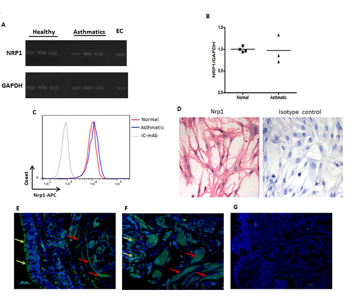 Expression of Nrp1 on HASMC