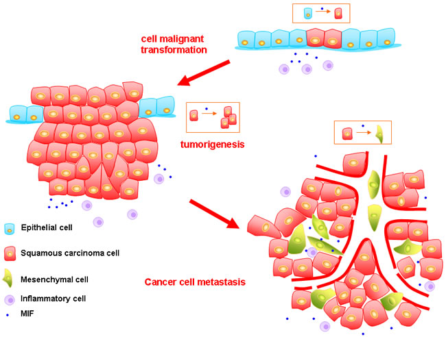 The model of how MIF promoting the progression of HNSCC.