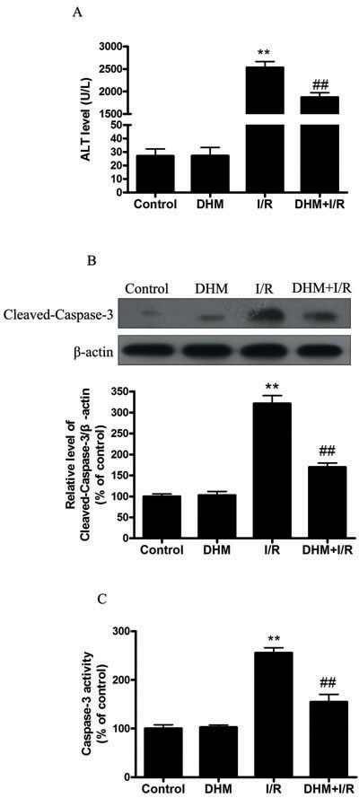 DHM reduces liver I/R injury in C57BL/6 mice.