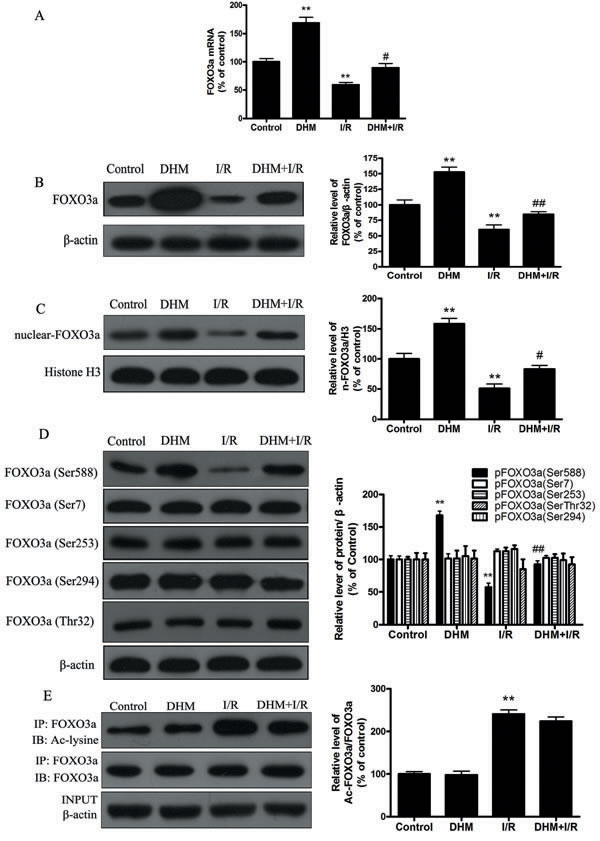 DHM significantly increases FOXO3a expression, and enhances FOXO3a nuclear translocation and phosphorylation modification after I/R.