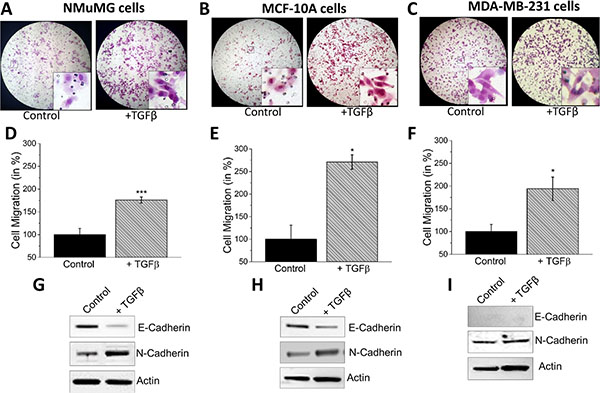 TGF&#x03B2; induces EMT in NMuMG, MCF-10a and MDA-MB-231 cells.