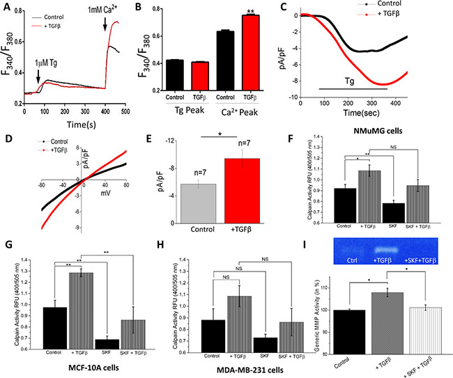 TGF&#x03B2; Increases store-operated Ca2+ entry and [Ca2+]i and blocking Ca2+ influx reduces EMT calpain activity.