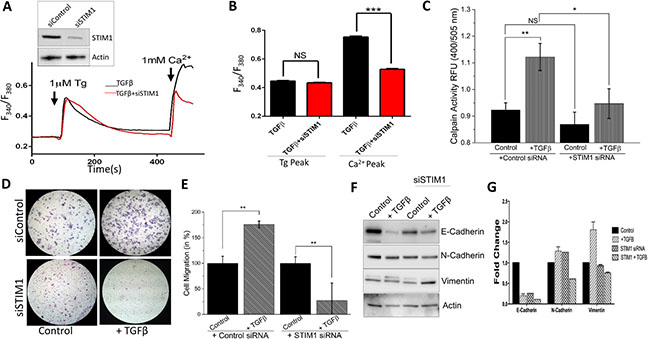 siSTIM1 reduces the effect of TGF&#x03B2; induced migration, calpain activity, current, and [Ca2+]i.