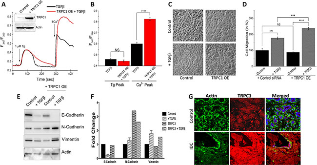 TRPC1 overexpression increases TGF&#x03B2; induced EMT.