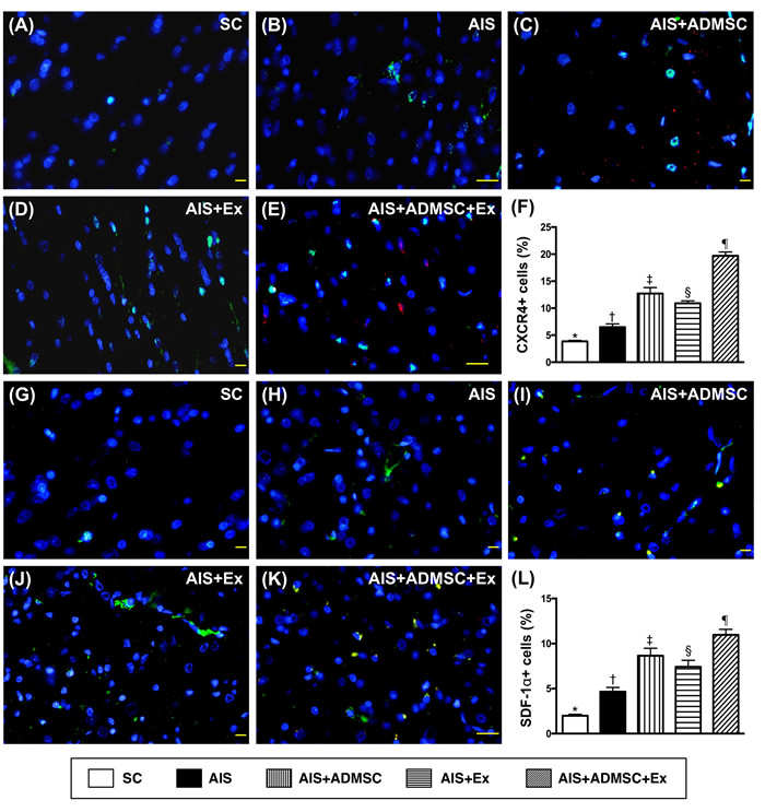 Microscopic findings of angiogenesis expressions in brain infarct zone by day 60 after AIS (