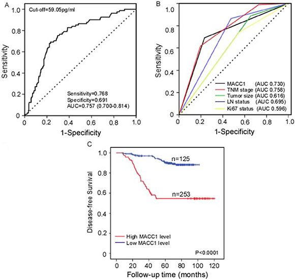 Serum MACC1 levels predict BC patient DFS.