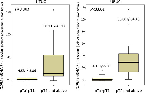 Quantitative real-time RT-PCR analysis discovers that DDR2 mRNA is significantly overexpressed in urinary tract urothelial carcinomas (UTUCs, left panel) and urinary bladder urothelial carcinomas (UBUCs, right panel) with higher primary tumor statuses.