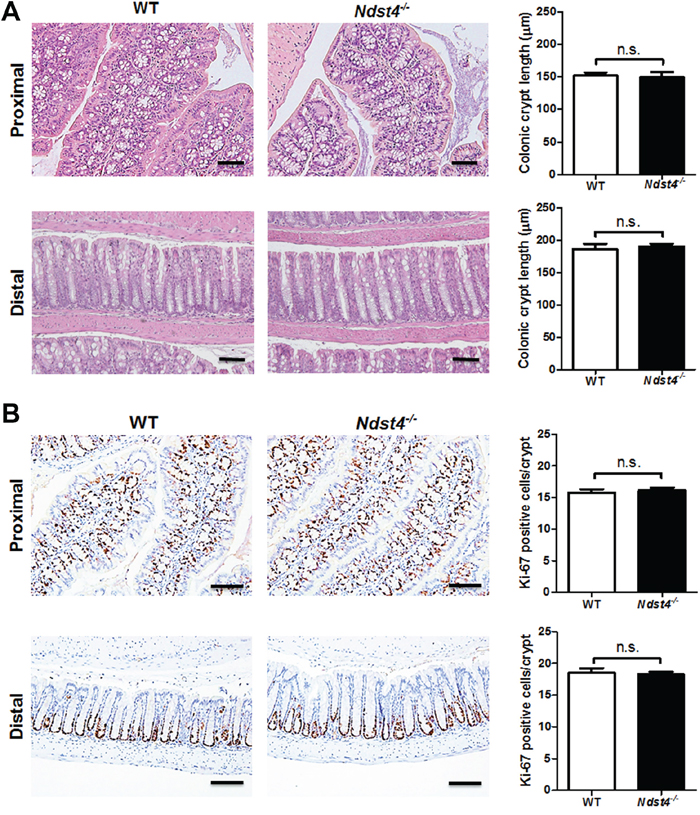 Ndst4 deficiency results in histological changes in the proximal colon.