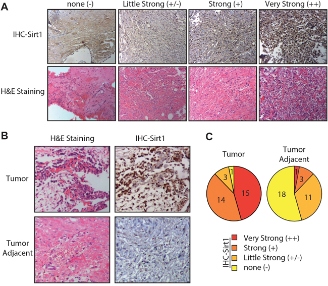 Osteosarcoma cells are associated with high sirtuin 1 (SIRT1) expression levels in vivo.