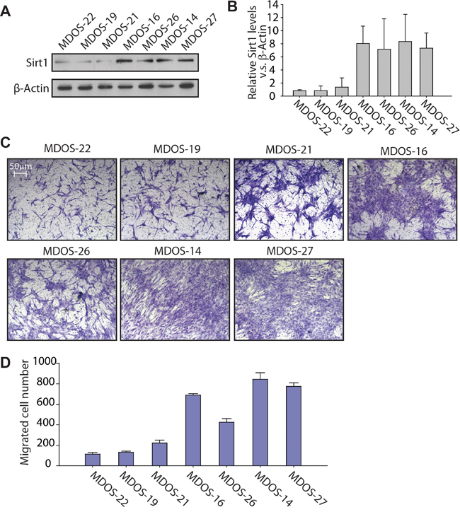 Primary osteosarcoma cells with higher expression of SIRT1 exert stronger migration ability in a Transwell migration assay.