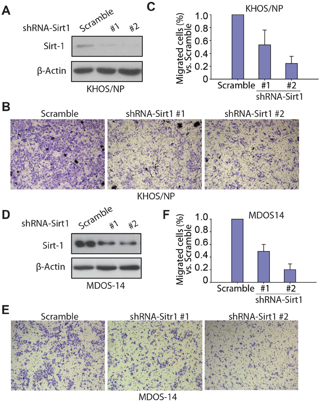 Knockdown of SIRT1 inhibits the migration ability of osteosarcoma cells in vitro.
