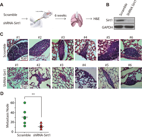 Knockdown of SIRT1 reduces lung metastasis of osteosarcoma cells in vivo.