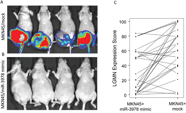 MiR-3978 expression levels dictate peritoneal metastasis of gastric cancer.