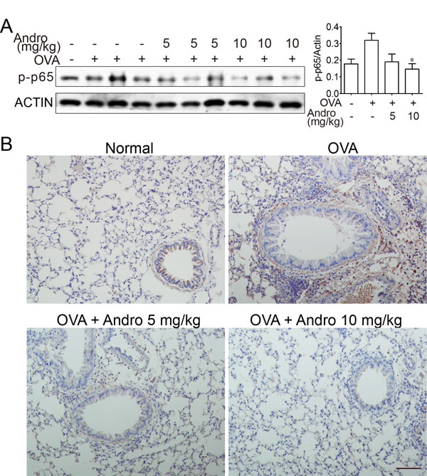 Andrographolide decreased activations of NF-&#x3ba;B in the lung of mice with OVA-induced asthma.