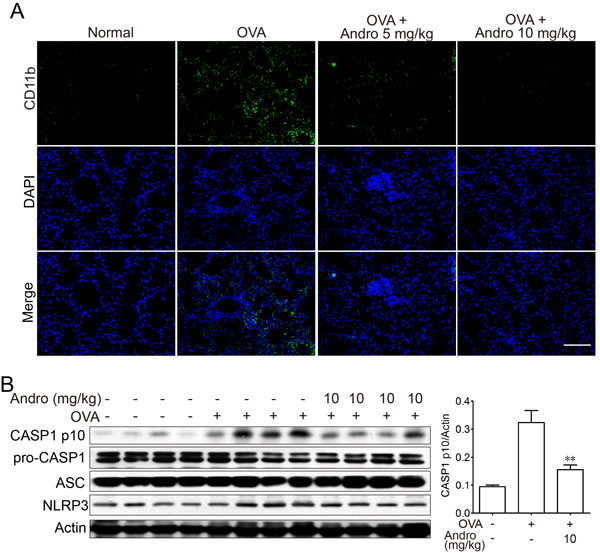 Andrographolide inhibited NLRP3 inflammasome activation in mice with OVA-induced asthma.