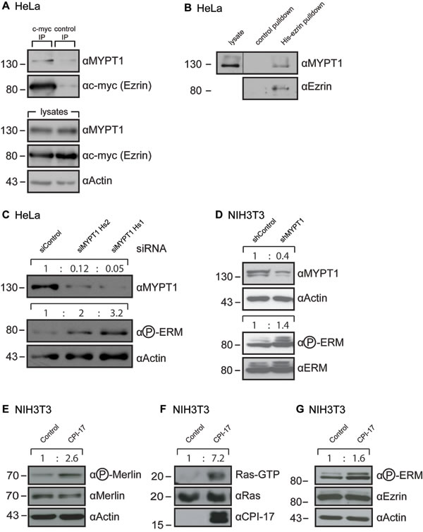 MYPT1 regulates ERM phosphorylation. (
