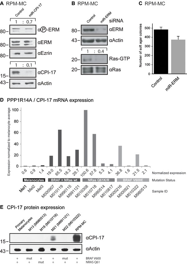 CPI-17 drives oncogenesis in RPM-MC cells and is frequently misexpressed in human melanoma samples. (