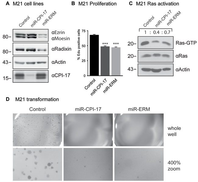 CPI-17 drives oncogenesis in patient-derived M21 melanoma cells. (