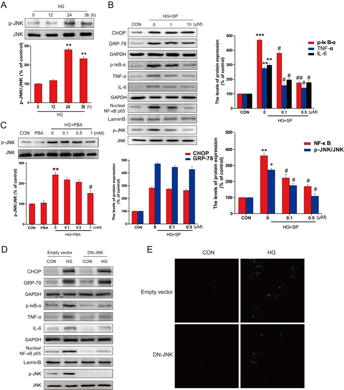 PBA administration inhibited the HG-induced p-JNK activation which was required for HG-induced inflammatory protein expression.